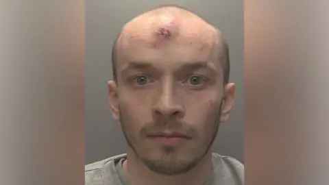 Humberside Police A police handout photo of Declan Wild in custody. He has balding hair, wears a grey t-shirt, and has a large abrasion on his forehead.