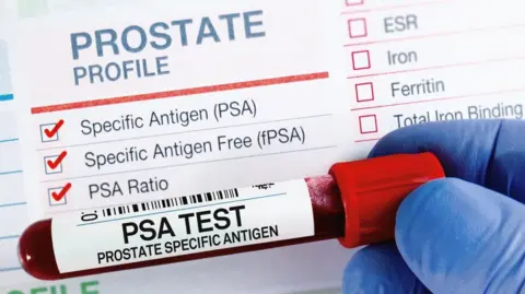 Getty Images A gloved hand holding a tube of blood labelled PSA Test Prostate Specific Antigen.