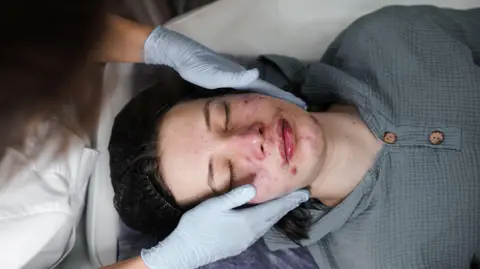 Getty Images A woman having acne treatment