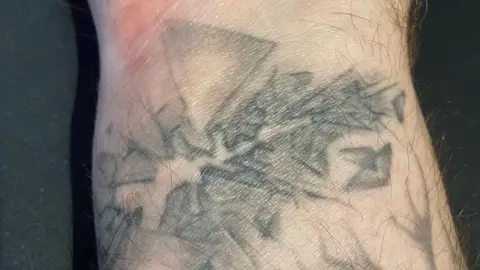 A close-up image of a man's wrist with discolored glass shards tattooed around a faint horizontal scar