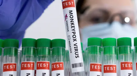 Reuters Tests for monkeypox virus