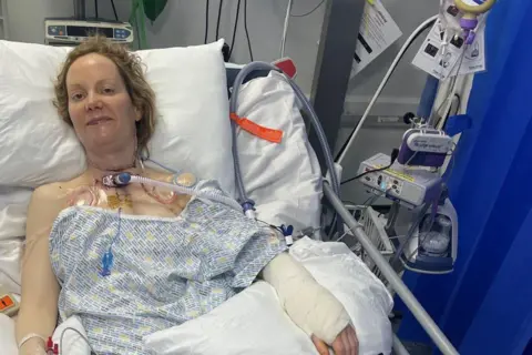 Lucy Turner Lucy is in a hospital bed. She has a trachea in her throat and there are other tubes in her arm. One of her arms is bandaged. She has a hospital gown on and is lying her head on pillows. Here hair is behind her head on the pillow.