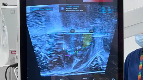 Close-up of a medical imaging monitor displaying a scan and measurement markers during a procedure, with clinical equipment visible around the screen.
