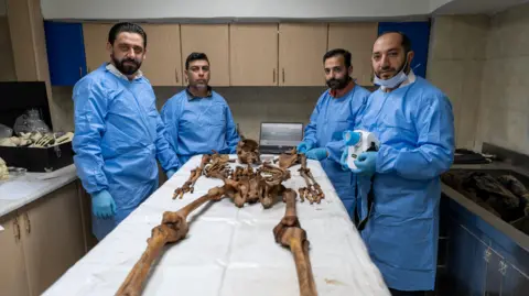  Dr Taj Eddin Shaker, Dr Anas al-Hourani, Dr Amer Saraqbi and Dr Yasser Al Qassem stand around a skeleton on a table.