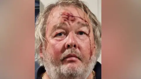 Christopher Mills Christopher Mills, with white hair and a beard, with a large cut on his forehead