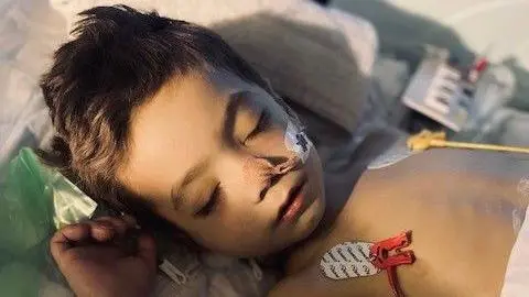 George's family George in hospital, with plasters and tubes attached