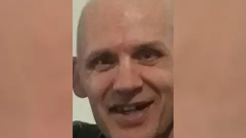 A man smiling with his teeth showing. He has a bald head and is wearing a dark top. 