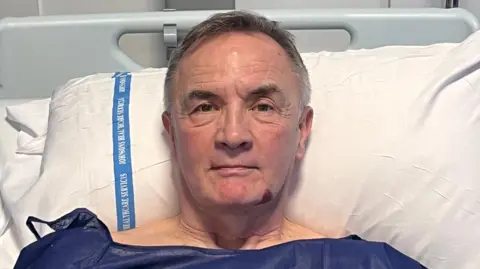 A man with short grey hair, wearing a dark blue hospital gown, photographed from the neck up, he is lying on a white pillow in a hospital bed. Staring at camera with a neutral expression.