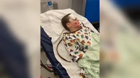Dan in a hospital bed. He has cuts to his face and chin and has a large bandage pad taped to his forehead. He is wearing a hospital gown.