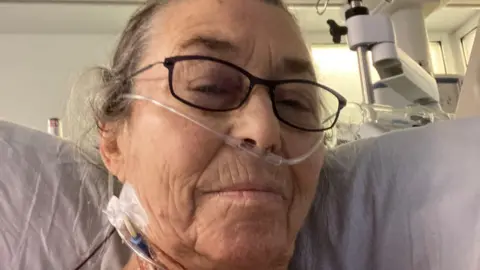 an older woman wearing glasses stares resolutely at the camera from a hospital bed, with medical tubes around her neck and a breathing tube in her nose