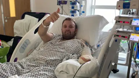 A picture of Jason taking in hospital. He is wearing a hospital gown and is smiling and giving a thumbs-up to the camera. His is attached to several different machines and his amputated left arm is shown heavily bandaged. 