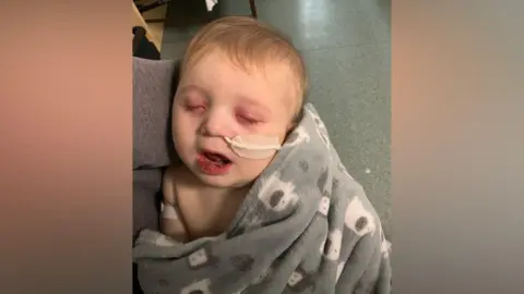 Family photo Hudson wrapped in a blanket in hospital, he has serious reddening around his eyes and mouth and a medical tube in his nose