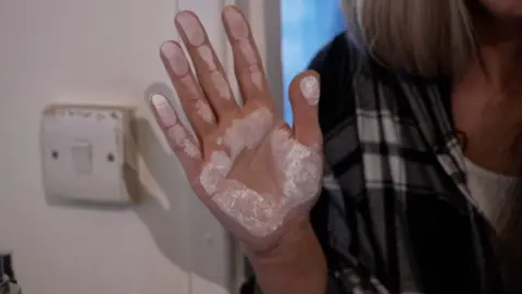 A woman holds her hand, which is covered with a white substance, to the wall