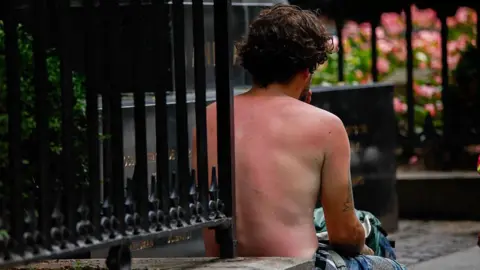 A man seen from behind with a red sunburnt back and arm. He's sat on a step with no top on.