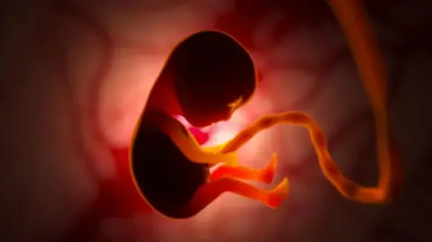 File photo of fetus
