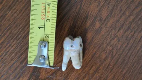 Ameila Bax A tooth next to a yellow tape measure. It measures at about 2.5cm and is on a dark wooden table.