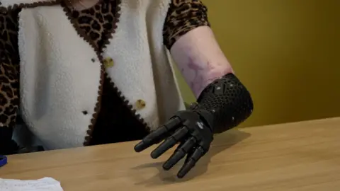 Close-up of Lily's black prosthetic arm resting on a wooden table. The arm has a textured design and articulated fingers. Part of the Lily's patterned clothing and handwritten notes are visible in the frame.
