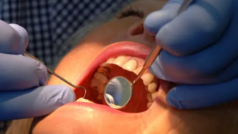 A woman with her mouth open during a dental inspection. The dentist is wearing blue surgical gloves and is holding dental instruments in the patient's mouth. while a light shines on her face.