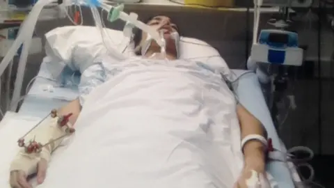 Matt Burgiss Matt Burgiss in a coma