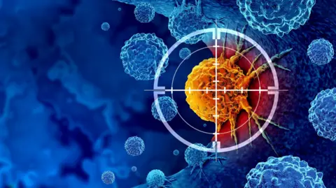 Getty Images Cancer cell