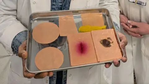 University of Huddersfield The image shows seven different shaped wound models on a silver tray, two of the skin-coloured models have clear wounds on them. The tray is being held up by two hands, in the background you can see white lab coats.