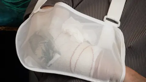 A close up view of Ally Whyatt's injured arm. A white sling and bandage cover the injured area. A pack of tissues has been placed inside the sling.