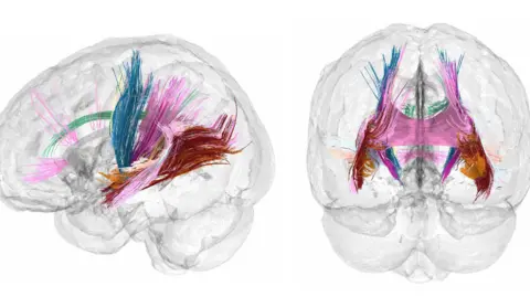     Daniella Coccio: Evidence that key pathways in the brain's white matter increase during pregnancy