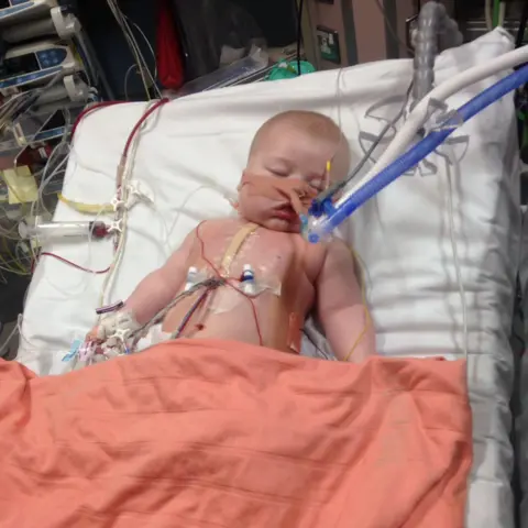 Family Vinnie as a baby in hospital, with wires attached to his chest and a breathing tube near his face