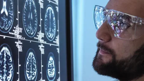 A scientist looks at a patient's brain scan results