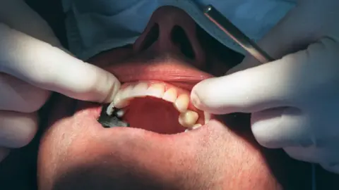 A close up shot of an open mouth. The hands of a dentist, in white plastic gloves, are raising the top lip to examine the upper teeth. 