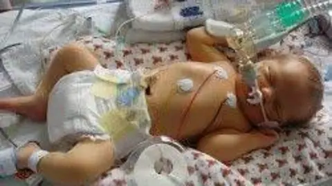 Charlotte Cheshire A newborn baby with a number of tubes and wires attached to nearby medical equipment. The baby is wearing a nappy and is lying on a patterned blanket.