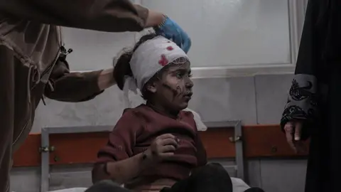 Anadolu via Getty Images An injured Palestinian girl has her head bandaged at al-Shifa hospital in Gaza City following an Israeli strike (19 November 2025)