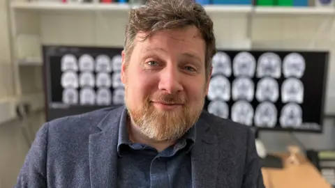 Close-up of Prof Cox with short hair and a beard, wearing a dark jacket over a shirt, looking at the camera in an indoor setting with blurred medical brain scan images displayed on a screen in the background.