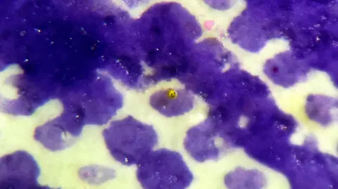 David A Lindon A close-up of The Yellow Smiley Face which is situated on a first-class stamp, on a micro dot on the eye of the late Queen Elizabeth II