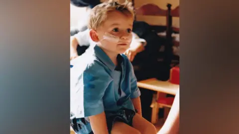 Pete Cuthbert Matthew is a young boy and is wearing a blue shirt and shorts. He has a feeding tube which stretches across his face between his nose and mouth.