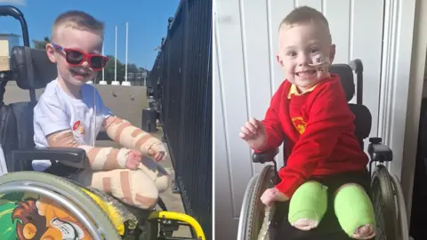Family handout Composite image of Dáibhin - a young, smiling boy. In the left image he is in a wheelchair, wearing a white shirt and red sunglasses. In the right image he is also in a chair, wearing a red nursery jumper and yellow polo shirt. In both images his legs are heavily bandaged, from amputation surgery.