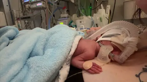 Family handout Levi, who is covered in a blue, fluffy blanket, is lying on Rebecca's chest. he is attached to medical equipment including a breathing tube. 