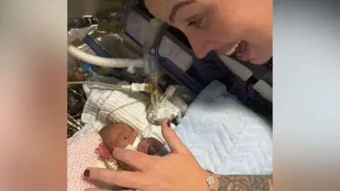 East Kent Hospitals NHS Trust A woman looking over a premature baby in a neonatal unit. 