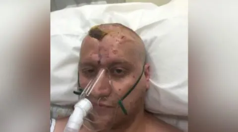 David Bown David Bown is lying in a hospital bed, with a pillow behind his head. He is wearing an oxygen mask and looking away from the camera.