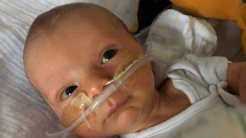 Orlando Davis, who died 14 days after being born by emergency caesarean