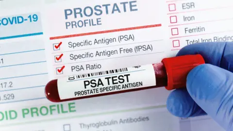 A generic shot of a close-up gloved hand holding a test tube with blood in it saying 'PSA Test' and Prostate Specific Antigen. There is a white data card behind with ticks against certain tests