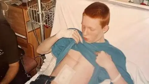 A boy with short red hair is in a hospital bed. He is lifting up a blue T-shirt and looking at a surgical covering on his chest.
