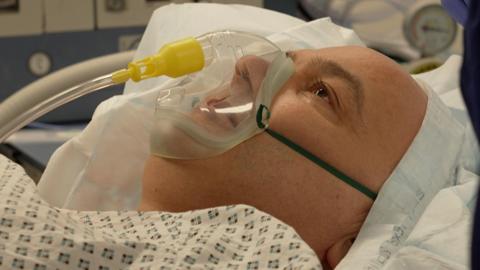 Sam Atherton suffers from pulmonary fibrosis