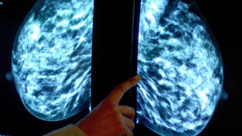 PA Media A mammogram showing a woman's breast in order to check for breast cancer. A person holds their hand up to the screen to point to part of the image. 