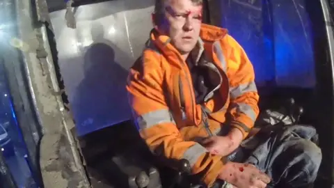 A man in an orange jacket with blood on his hands and head