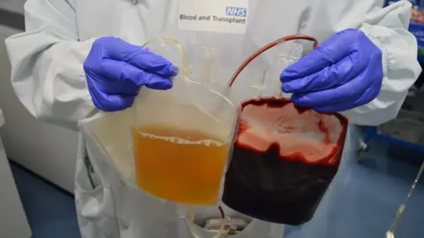 NHSBT A medical professional holding two bags, showing plasma separated out of red blood cells.