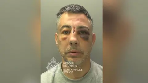South Wales Police A man stood being photographed for a police mugshot. He has a black eye, a gash on his nose and is wearing a grey jumper.
