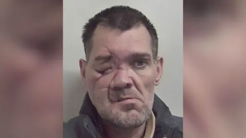 Kent Police A custody image of a man with short black hair. He is looking into the camera and is stood in front of a grey background. The right side of the man's face has significant scarring, and his eye is closed.