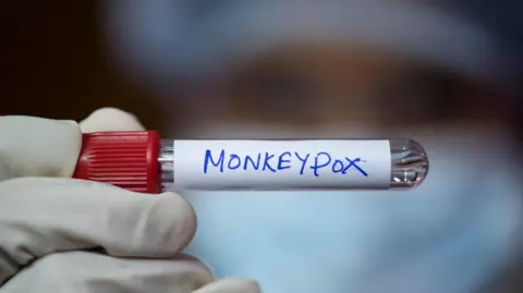Getty Images A hand wearing a white glove holds a test vial, which has monkeypox written on the label attached to it.