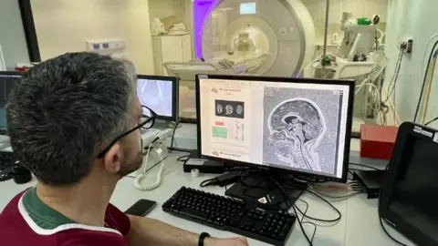 A consultant radiologist at Great Ormond Street Hospital reviews the brain scan and AI report of a child with complex epilepsy